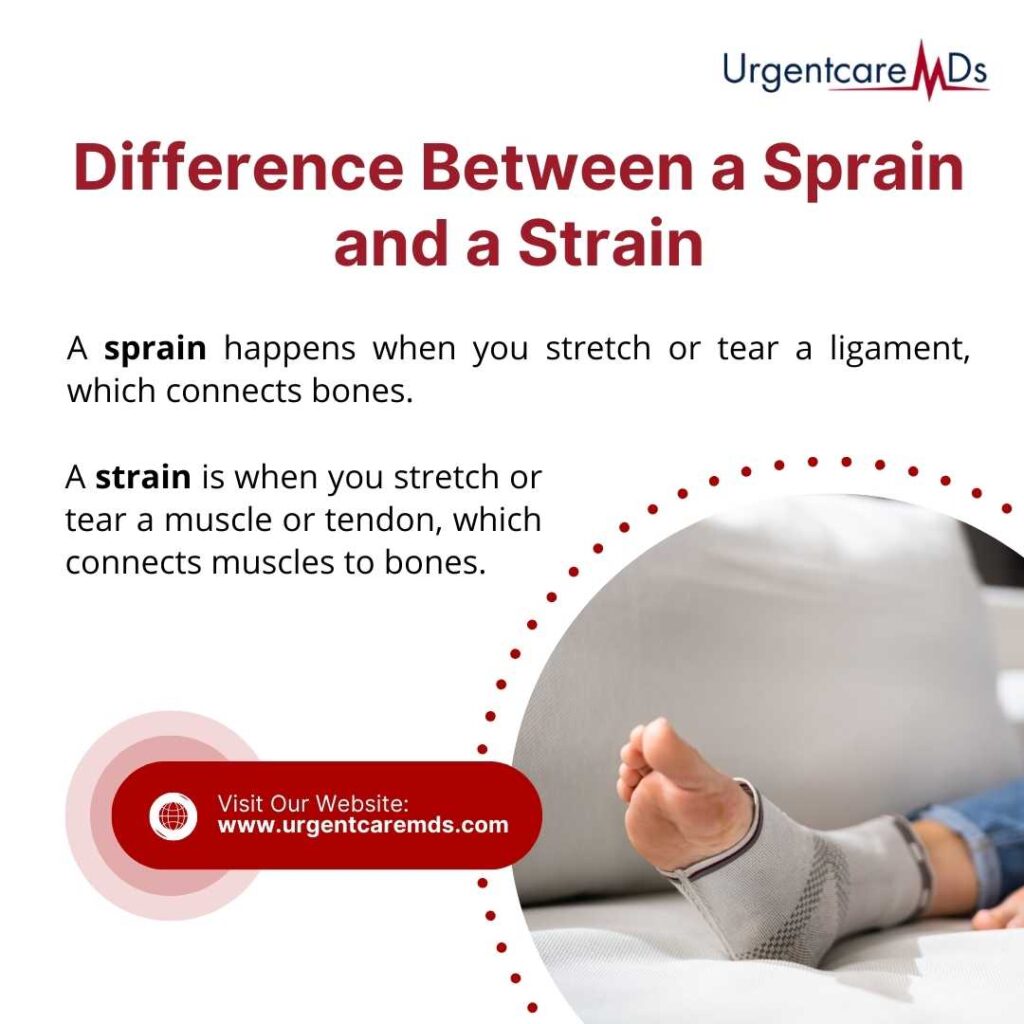 Sprains and Strains: Where Should I Go for Care?